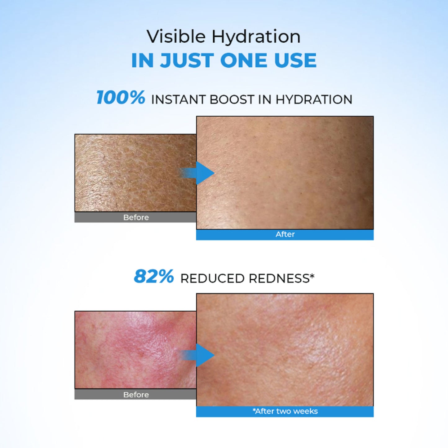 Conscious Chemist Hyaluronic Acid Lightweight Gel Moisturizer For Intense Hydration