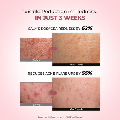 Conscious Chemist 10% Azelaic Acid Gel Cream for redness relief and acne treatment, showing the product tube and packaging.