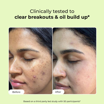 Conscious Chemist Salicylic Acid face wash with glycolic acid and CICA extract for oily, acne-prone skin, visible in the image.