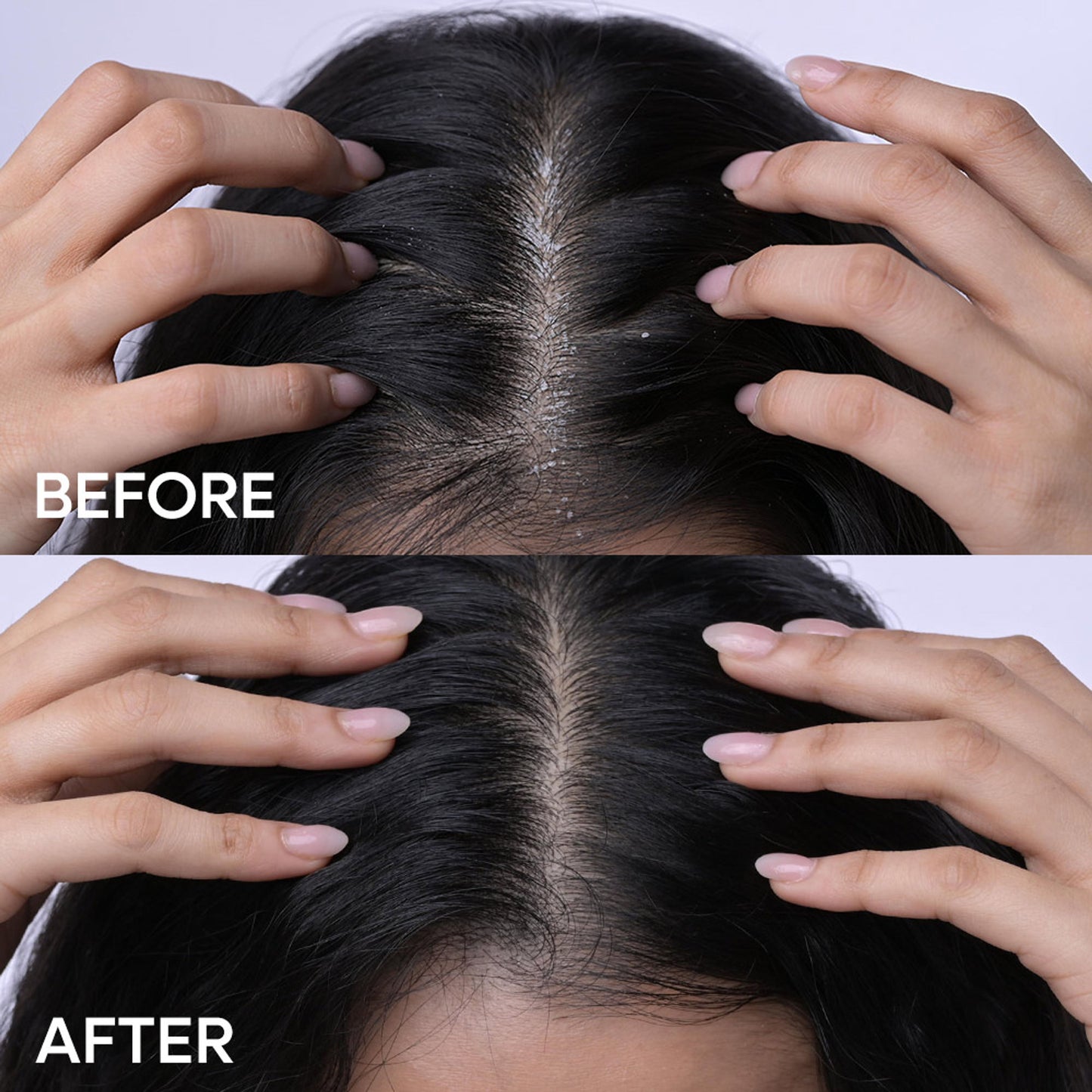 Naturali Anti-Dandruff Hair Mask With Hemp, Sage & Salicylic Acid
