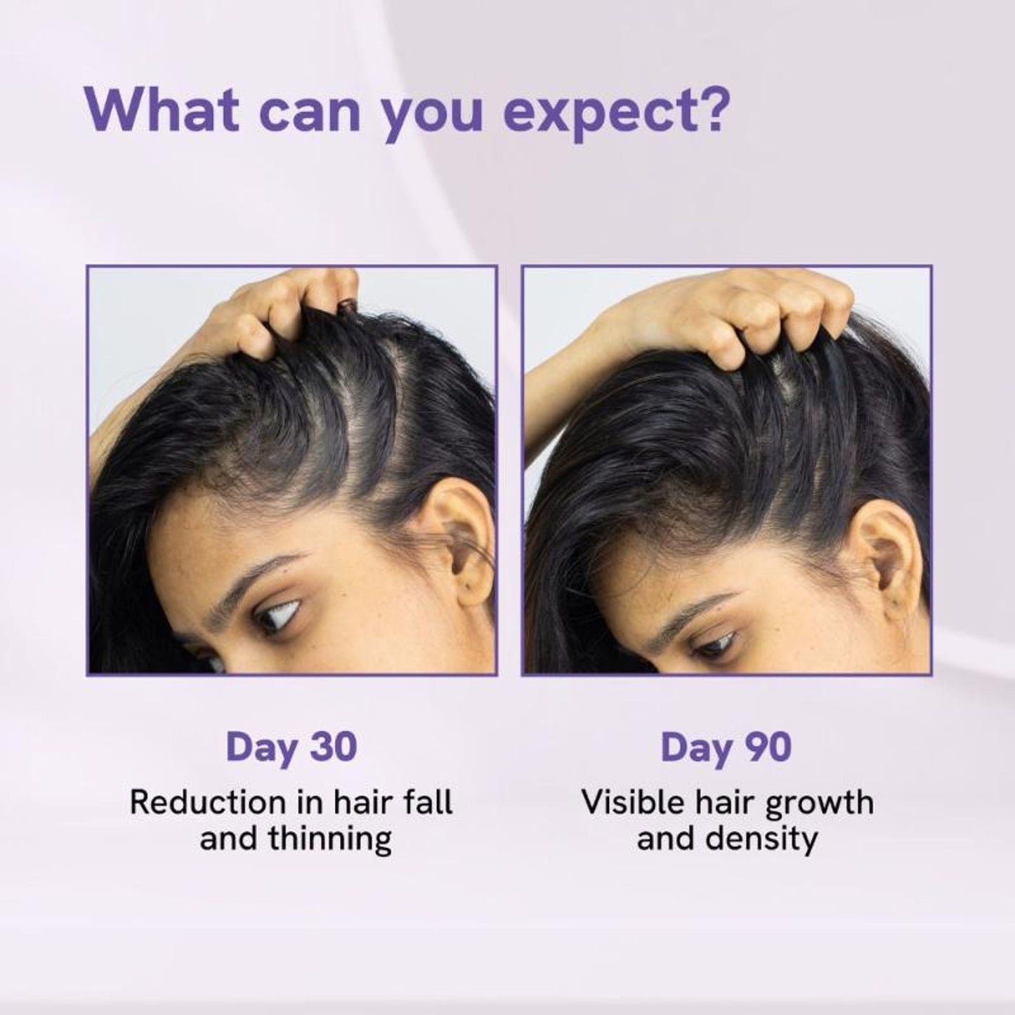 Be Bodywise Advanced Hair Growth Serum - 3% Rosemary, 3% Redensyl, 2% Aminexil - For New Hair Growth
