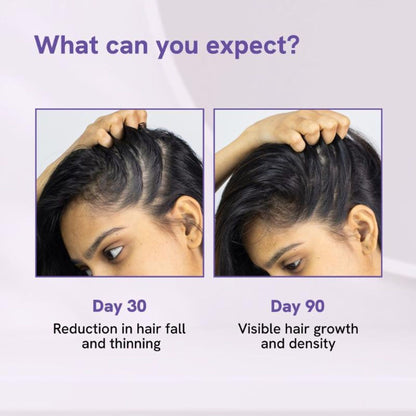 Be Bodywise Advanced Hair Growth Serum - 3% Rosemary, 3% Redensyl, 2% Aminexil - For New Hair Growth