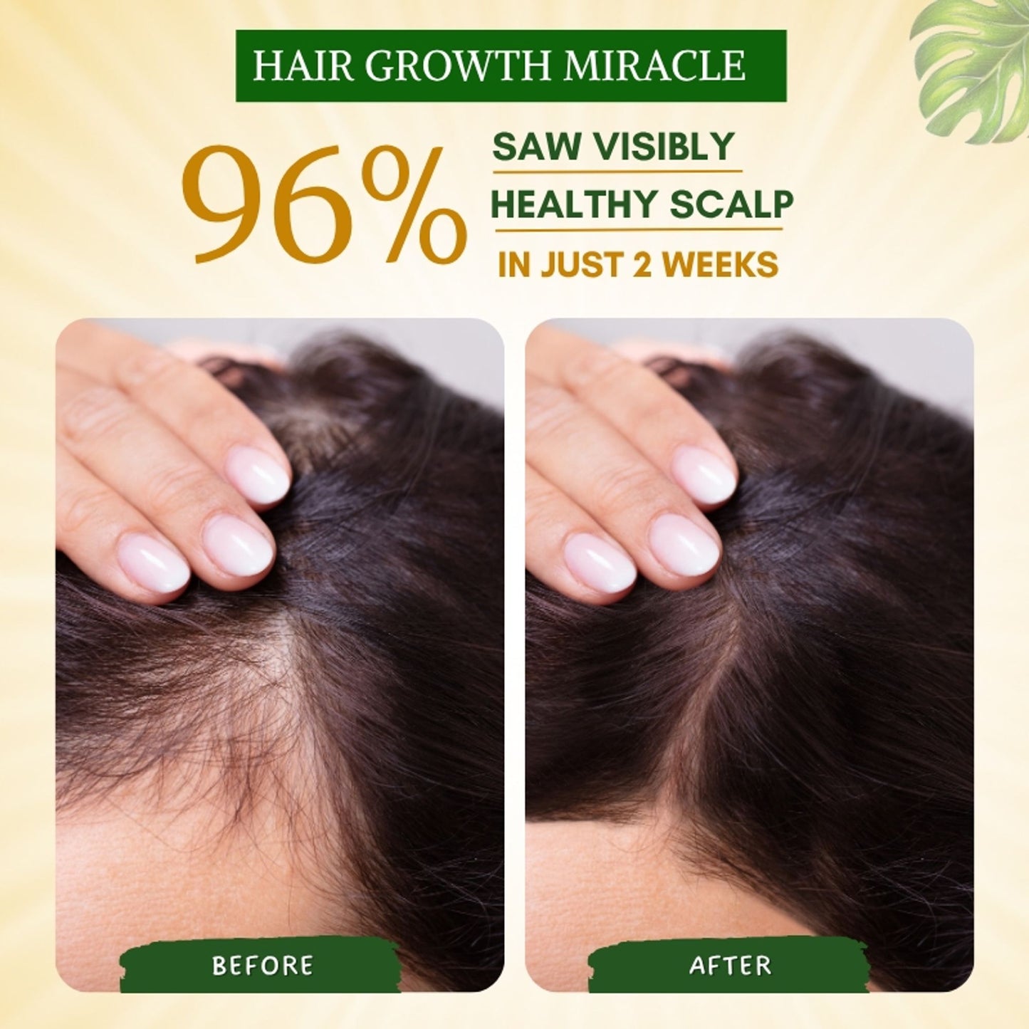 Mystiq Living Rosemary Water Hair Spray, Promotes Hair Growth, Anti Frizz & Damage Control