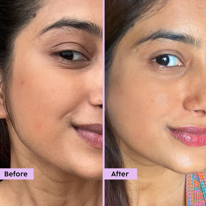 Plix FIX Jamun Clarifying Fruity Toner