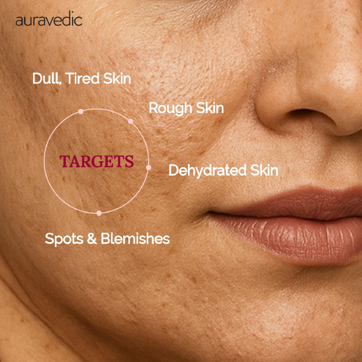 Auravedic Kumkumadi Face Cream With Kumkumadi Tailam Kumkumadi Face Oil Pigmentation Cream