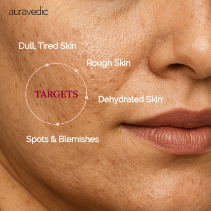Auravedic Kumkumadi Face Cream With Kumkumadi Tailam Kumkumadi Face Oil Pigmentation Cream