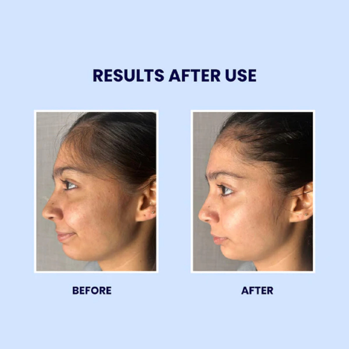 SUROSKIE Gluta Boost Face Wash for Men & Women With Niacinamide for Skin