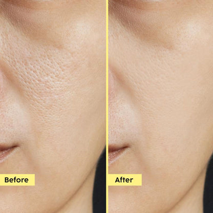 Plix Pineapple 3% Hyloglo PHA Alcohol Free Face Toner