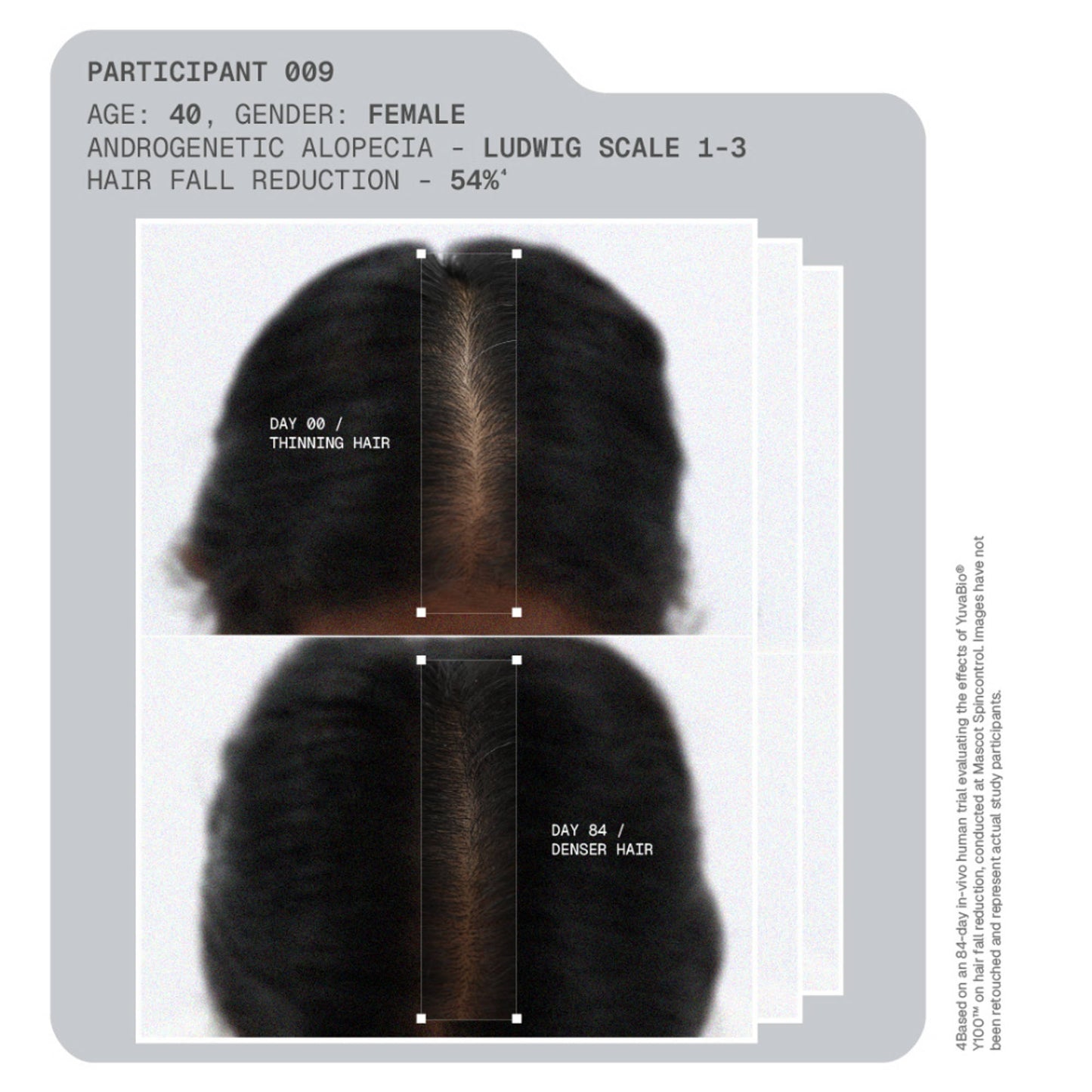 ARATA MitoActive Hair Growth Serum India's First Mitochondrial Hair Growth Serum Reduces Hair Fall