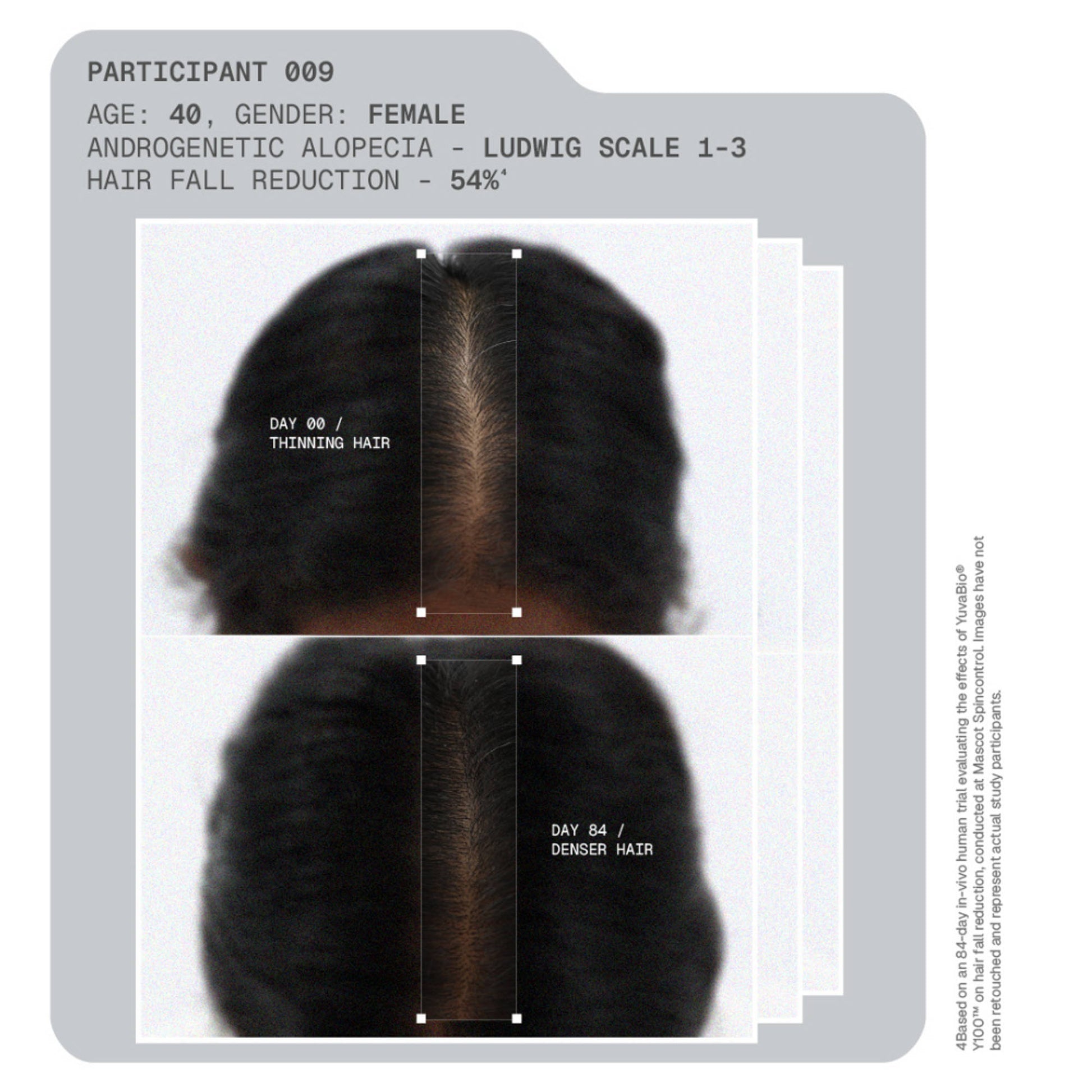 ARATA MitoActive Hair Growth Serum India's First Mitochondrial Hair Growth Serum Reduces Hair Fall