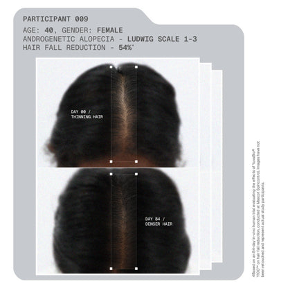 ARATA MitoActive Hair Growth Serum India's First Mitochondrial Hair Growth Serum Reduces Hair Fall