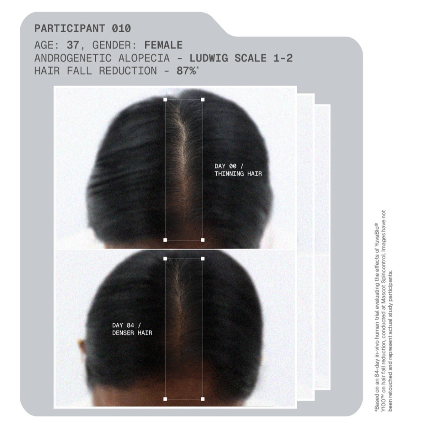 ARATA MitoActive Hair Growth Serum India's First Mitochondrial Hair Growth Serum Reduces Hair Fall