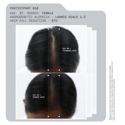 ARATA MitoActive Hair Growth Serum India's First Mitochondrial Hair Growth Serum Reduces Hair Fall