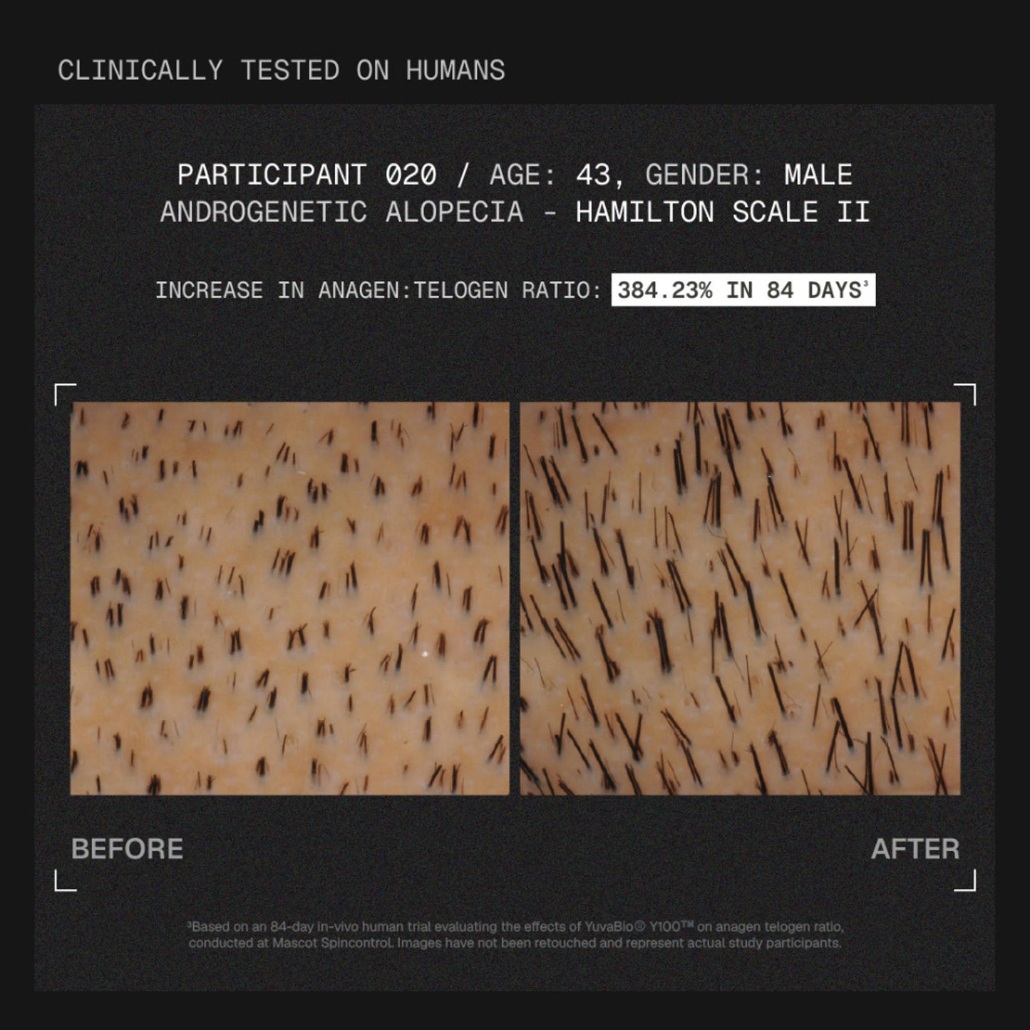 ARATA MitoActive Hair Growth Serum India's First Mitochondrial Hair Growth Serum Reduces Hair Fall