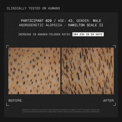 ARATA MitoActive Hair Growth Serum India's First Mitochondrial Hair Growth Serum Reduces Hair Fall