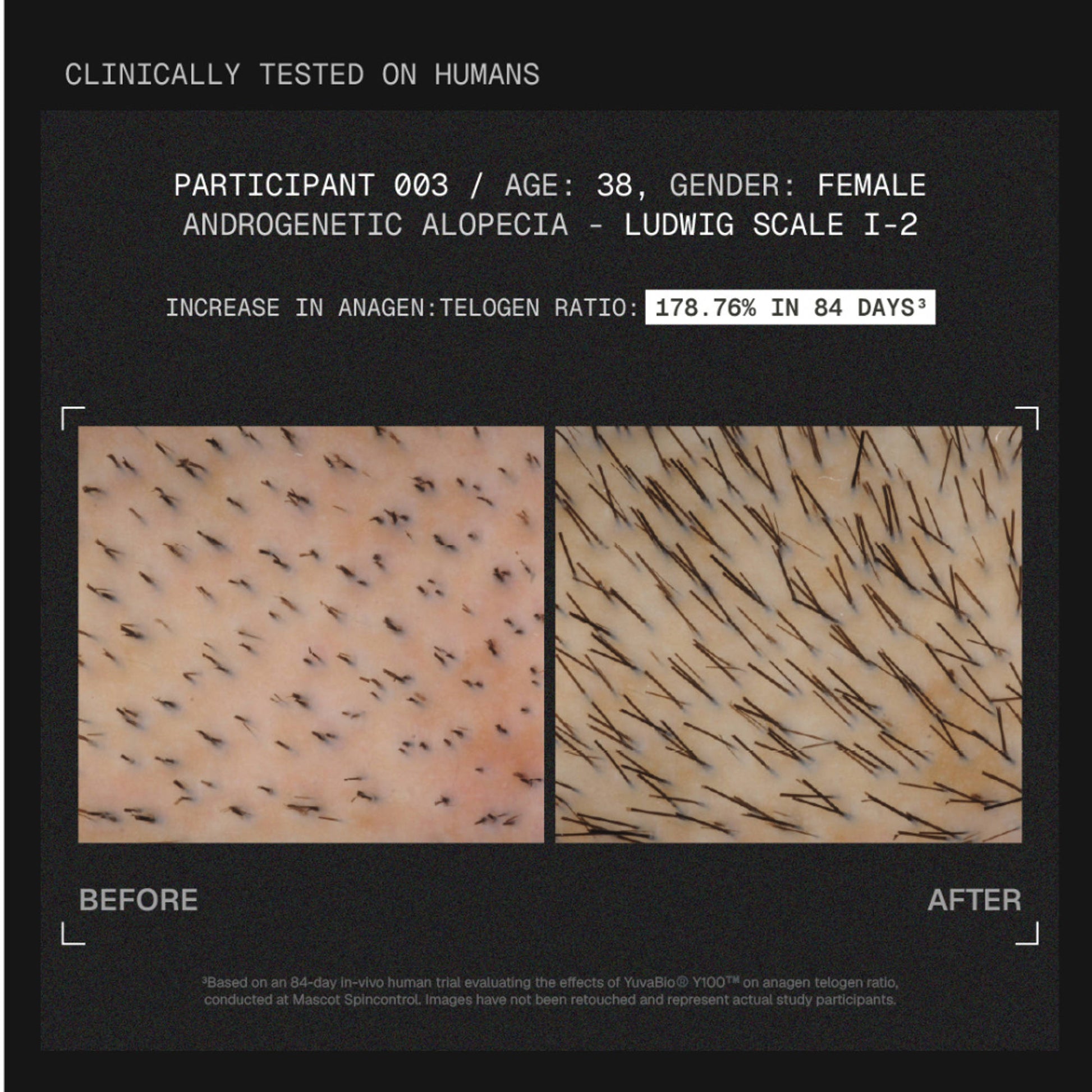 ARATA MitoActive Hair Growth Serum India's First Mitochondrial Hair Growth Serum Reduces Hair Fall