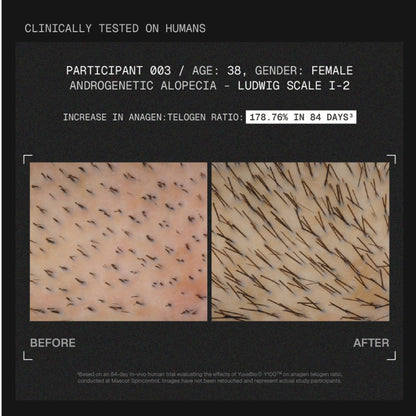 ARATA MitoActive Hair Growth Serum India's First Mitochondrial Hair Growth Serum Reduces Hair Fall