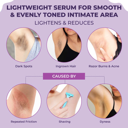Sanfe Spotlite Sensitive Body Serum For Dark Underarms, 2% Glycolic Acid & 4% Niacinamide