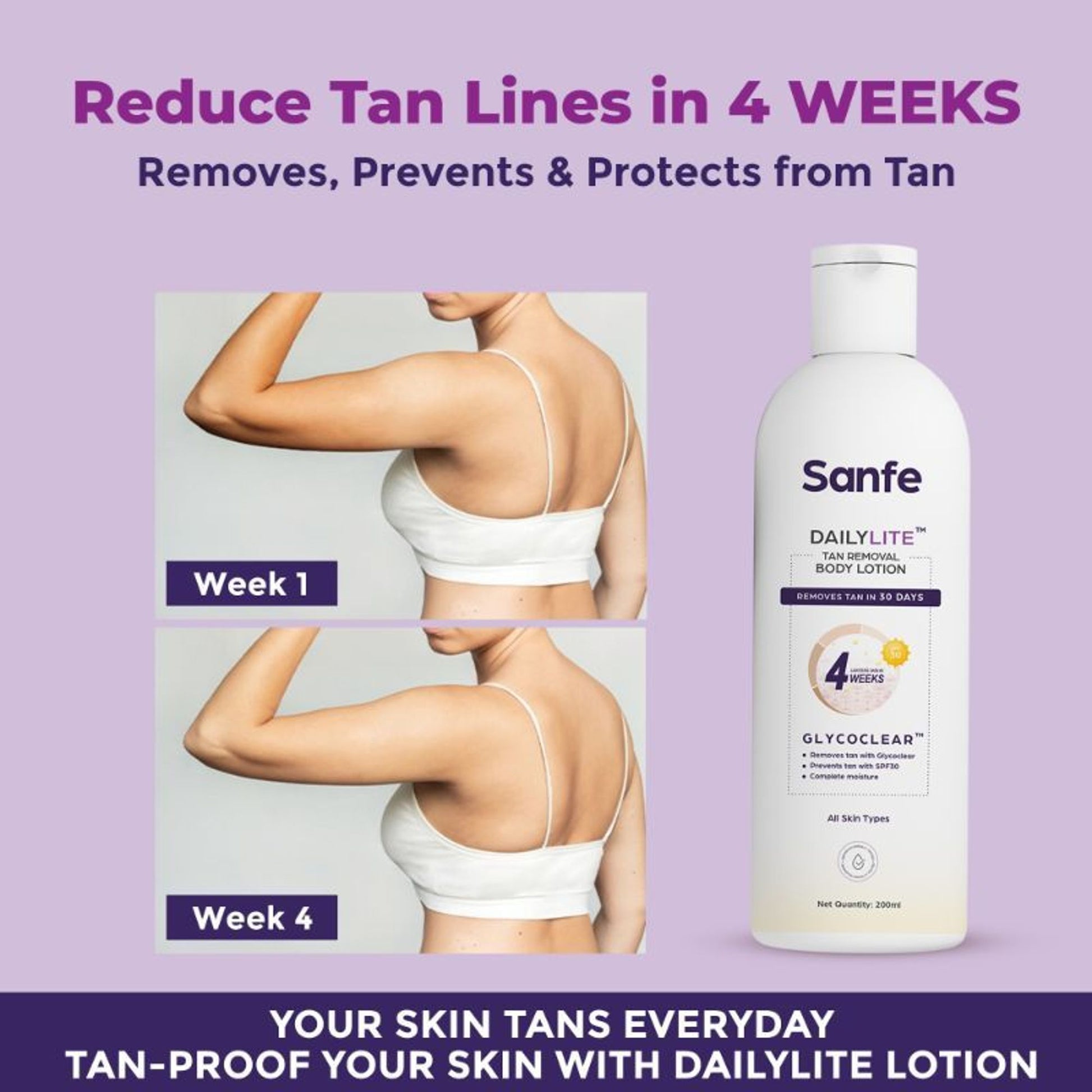 Sanfe Dailylite Tan Removal Body Lotion For Women Remove Tan With SPF 30 Body Moisturizer Cream