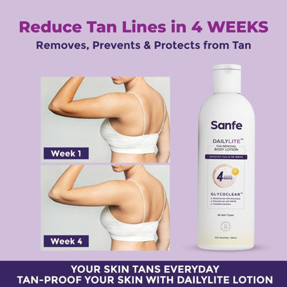 Sanfe Dailylite Tan Removal Body Lotion For Women Remove Tan With SPF 30 Body Moisturizer Cream