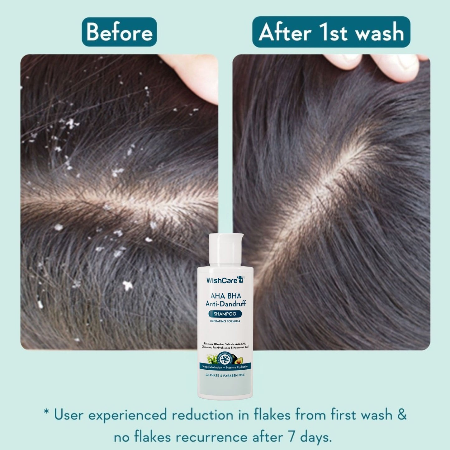 WishCare Hydrating AHA BHA Anti Dandruff Shampoo with Salicylic Acid - 100% Dandruff Reduction
