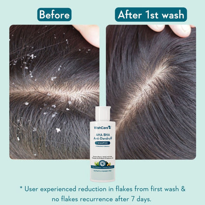 WishCare Hydrating AHA BHA Anti Dandruff Shampoo with Salicylic Acid - 100% Dandruff Reduction