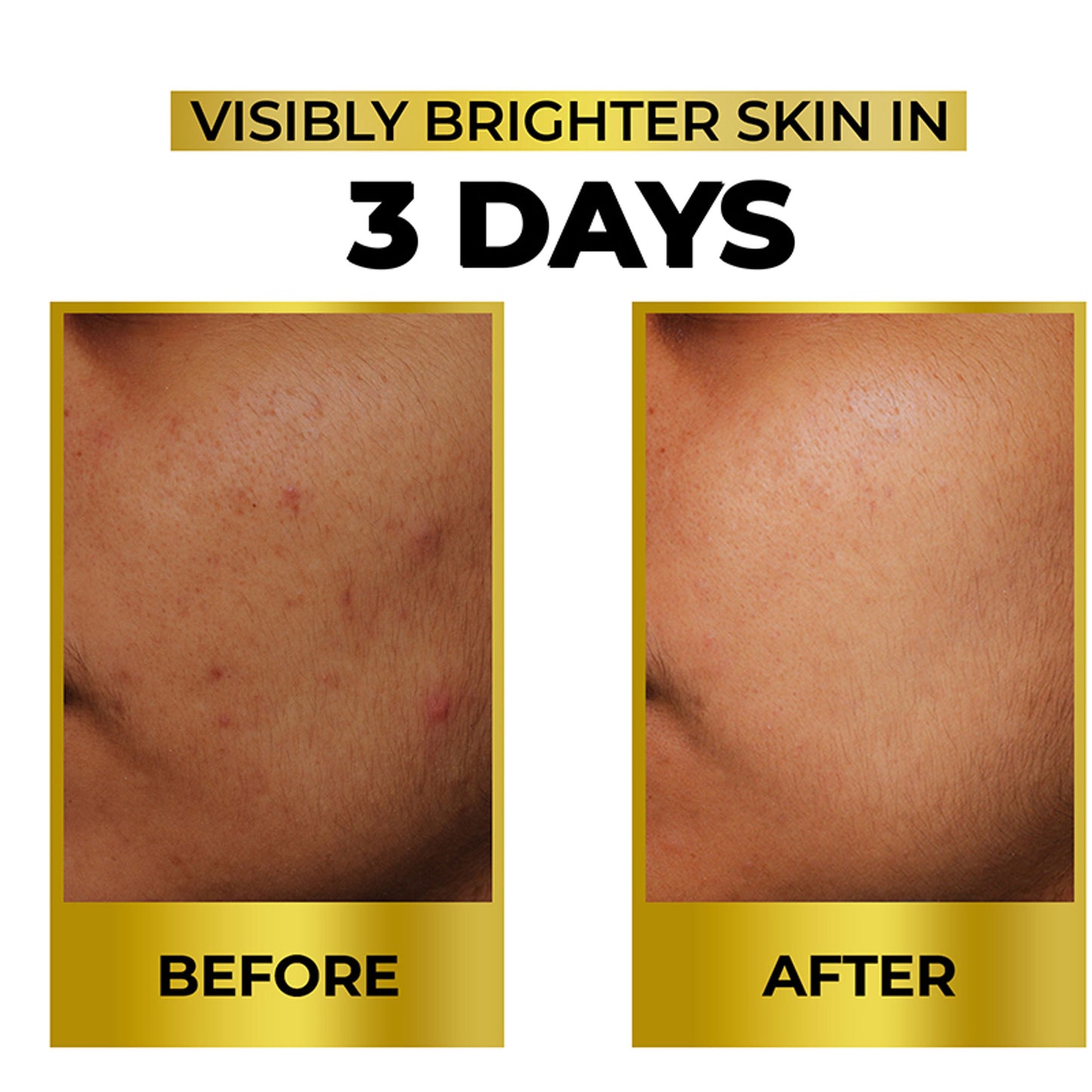 Streax Bright & Shine Face Serum For Brightening, Dark Spots Reduction
