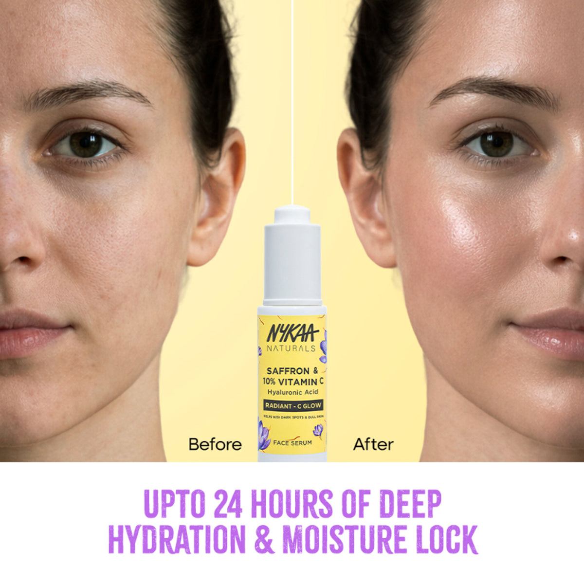 Nykaa Naturals 10% Vitamin C Radiant-C Glow Serum to Fade Dark Spots & Brighten Dull, Tired Skin