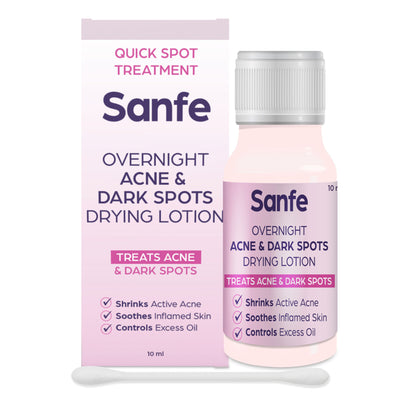 Sanfe Overnight Acne Drying Lotion, Salicylic Acid & Calamine Acne Spot Corrector, Pimple Clearing