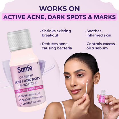 Sanfe Overnight Acne Drying Lotion, Salicylic Acid & Calamine Acne Spot Corrector, Pimple Clearing