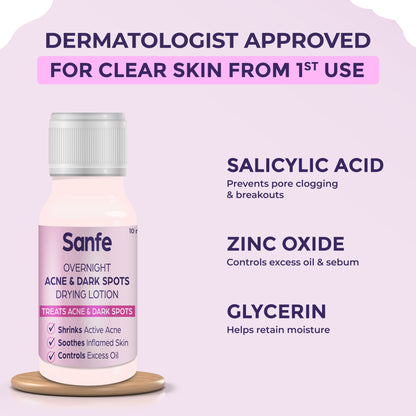Sanfe Overnight Acne Drying Lotion, Salicylic Acid & Calamine Acne Spot Corrector, Pimple Clearing