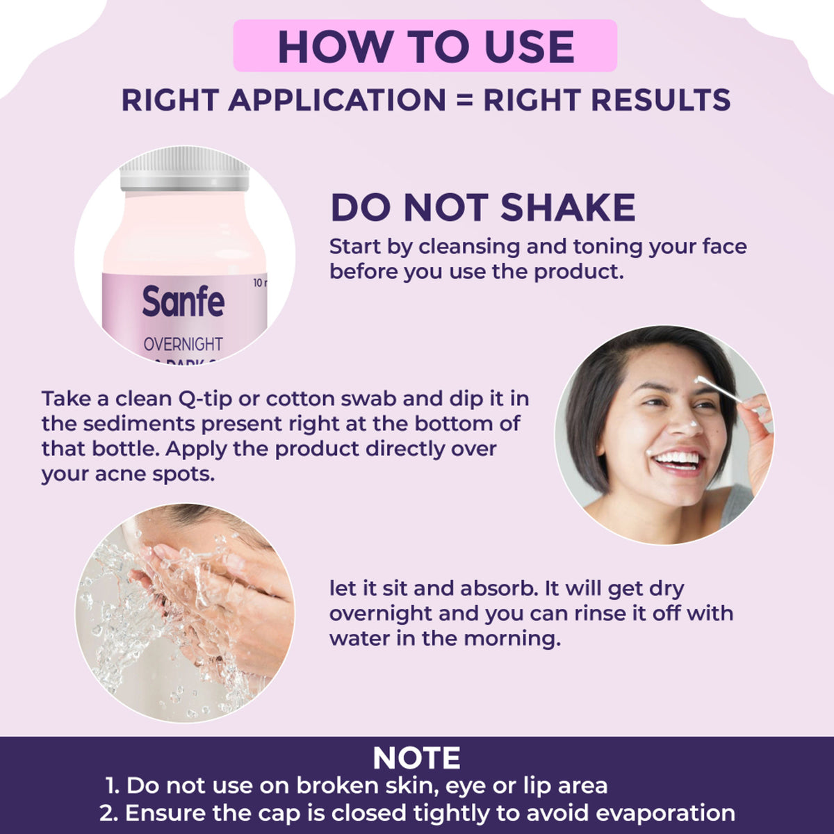 Sanfe Overnight Acne Drying Lotion, Salicylic Acid & Calamine Acne Spot Corrector, Pimple Clearing