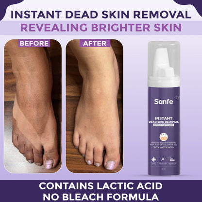 Sanfe Instant Dead Skin Removal Exfoliating Mousse | Visibly Removes Tan, Exfoliates - 60 ml