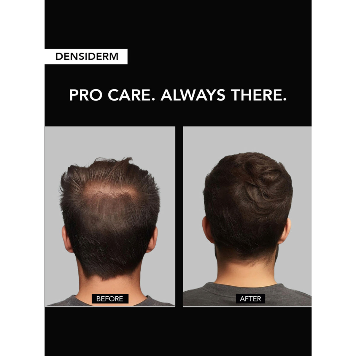O3+ Men Densiderm Hair Growth Scalp Serum Spray For Anti Hair Loss With Ginseng