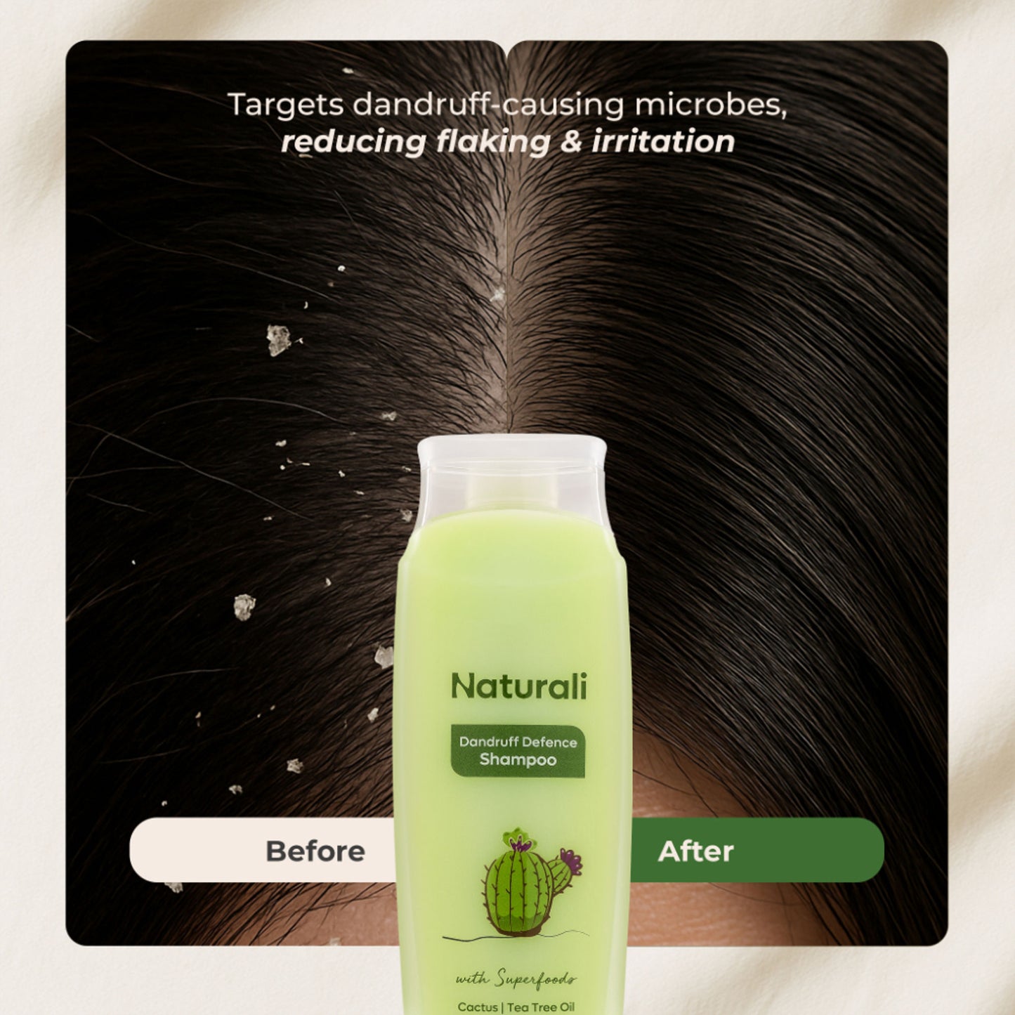 Naturali Dandruff Defence Shampoo with Tea Tree Oil & Cactus Extracts That Prevents Dandruff 370ml