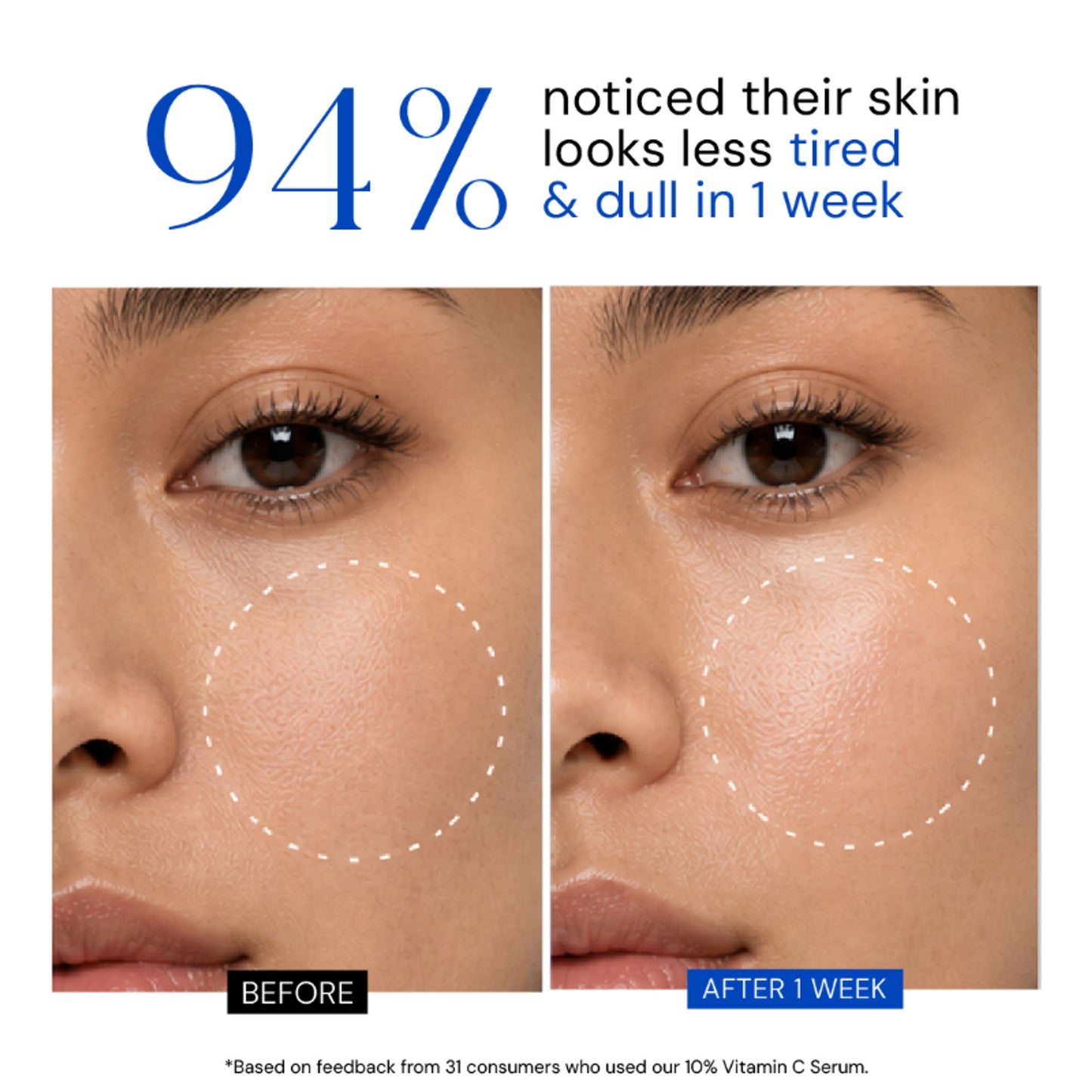 Lumineve 10% Vitamin C & Collagen Face Serum with Peptide+ Ferulic Acid, Pigmentation & Bright Skin