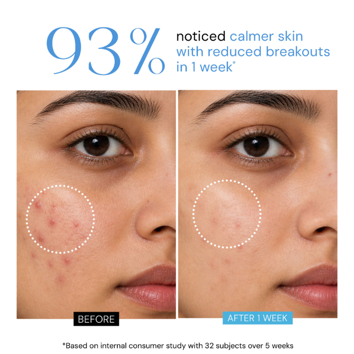 Lumineve Gel Crème with Niacinamide, Collagen, Peptide, Ultra-Light Texture for Oily Acne-Prone skin