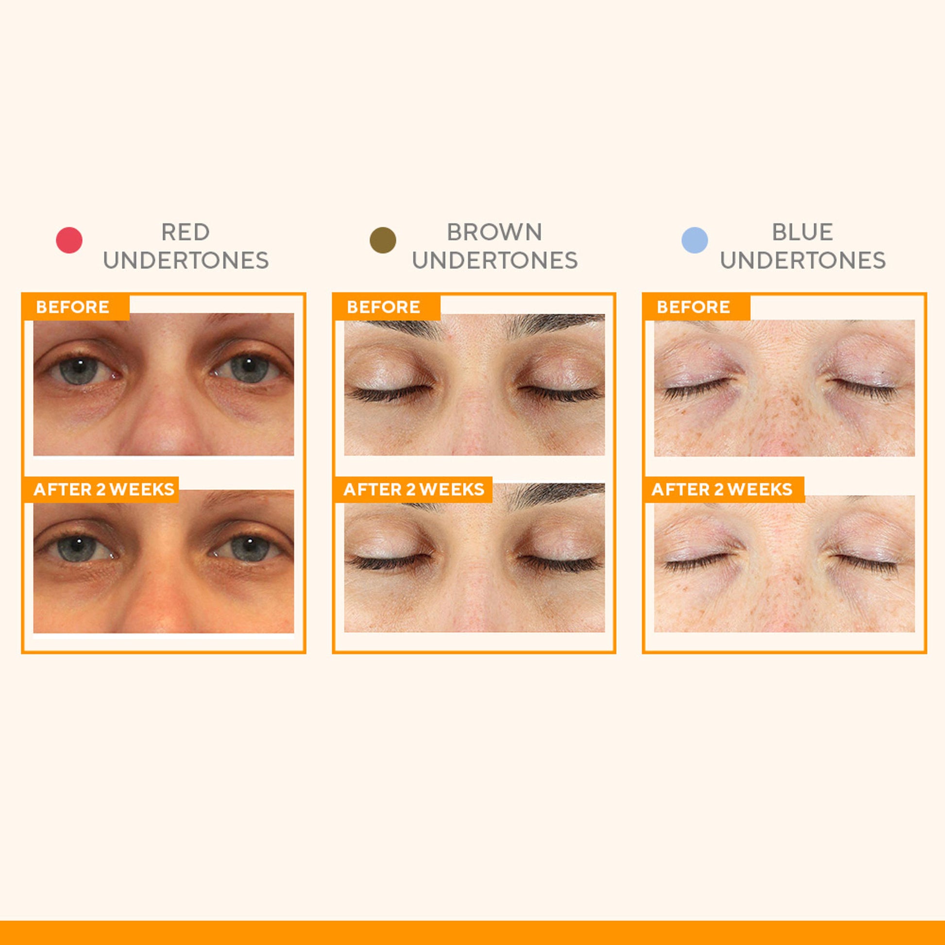 Murad Vitamin C Eyes Dark Circle Corrector