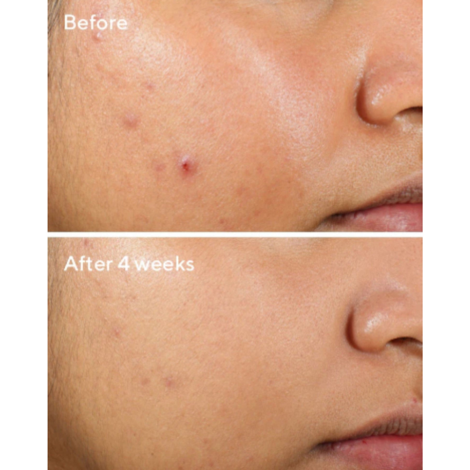 Murad Clarifying Water Gel