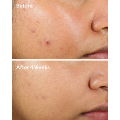Murad Clarifying Water Gel