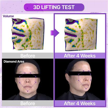 Bioheal Boh Probioderm 3D Lifting Ampoule - Firming Korean Serum Reduces Signs of Aging