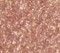 Flare