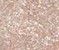 001 Sweet Champagne