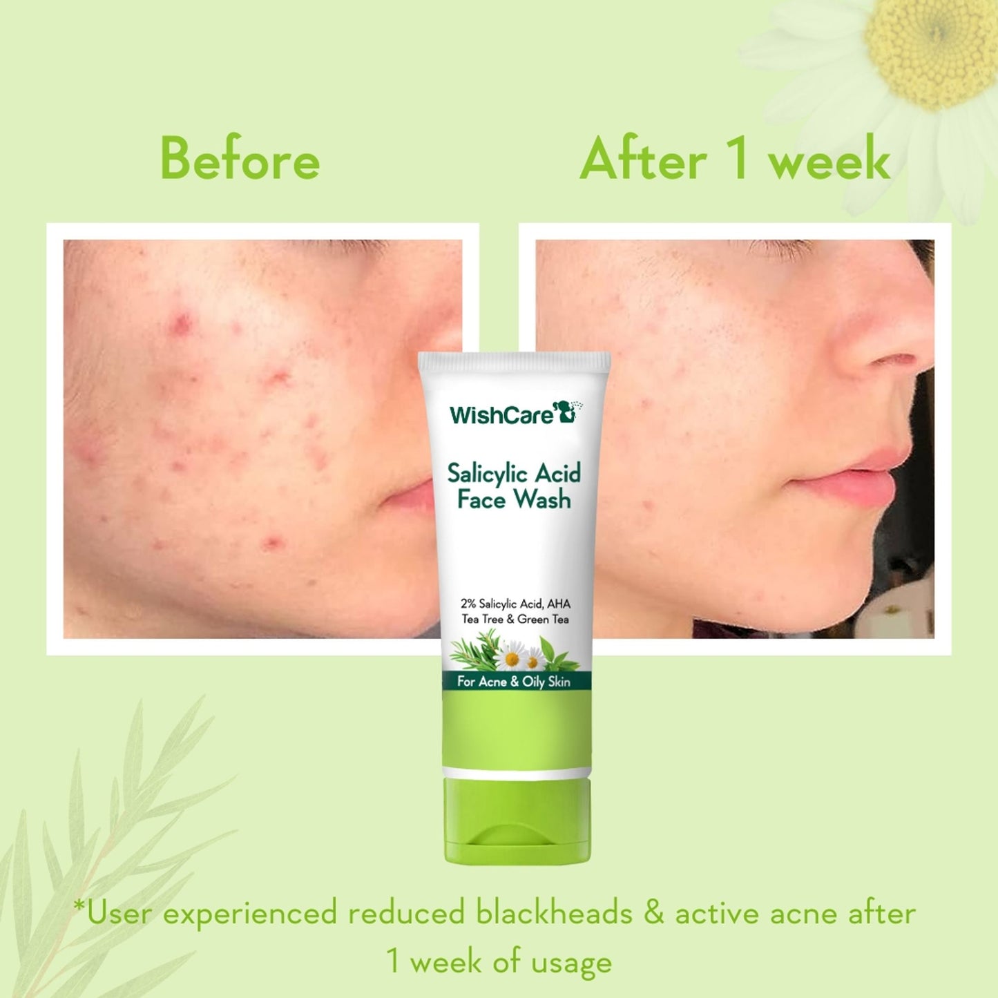 WishCare 2% Salicylic Acid Face Wash with AHA, Greentea & Tea Tree -Oil Control-Reduces Sebum & Acne