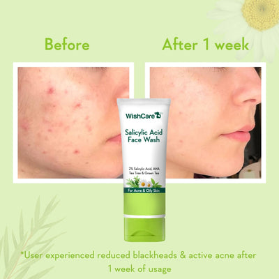 WishCare 2% Salicylic Acid Face Wash with AHA, Greentea & Tea Tree -Oil Control-Reduces Sebum & Acne