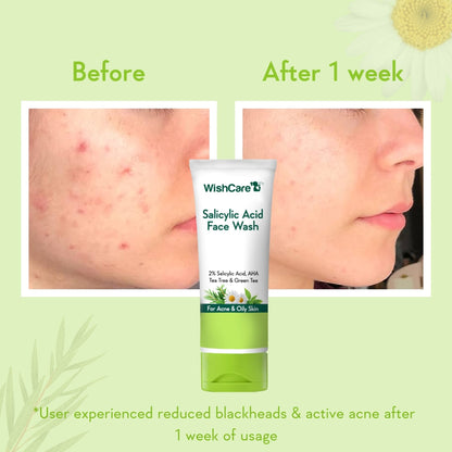 WishCare 2% Salicylic Acid Face Wash with AHA, Greentea & Tea Tree -Oil Control-Reduces Sebum & Acne