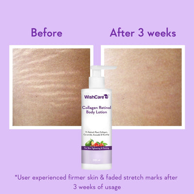 WishCare Collagen 1% Retinol Anti-Ageing Body Lotion With Niacinamide For Skin Tightening & Firming