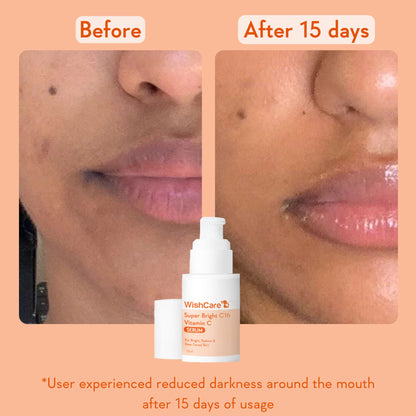 WishCare Super Bright C16 Vitamin C Face Serum for Glowing Skin- Reduces Pigmentation & Dark Spots