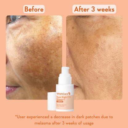 WishCare Super Bright C16 Vitamin C Face Serum for Glowing Skin- Reduces Pigmentation & Dark Spots