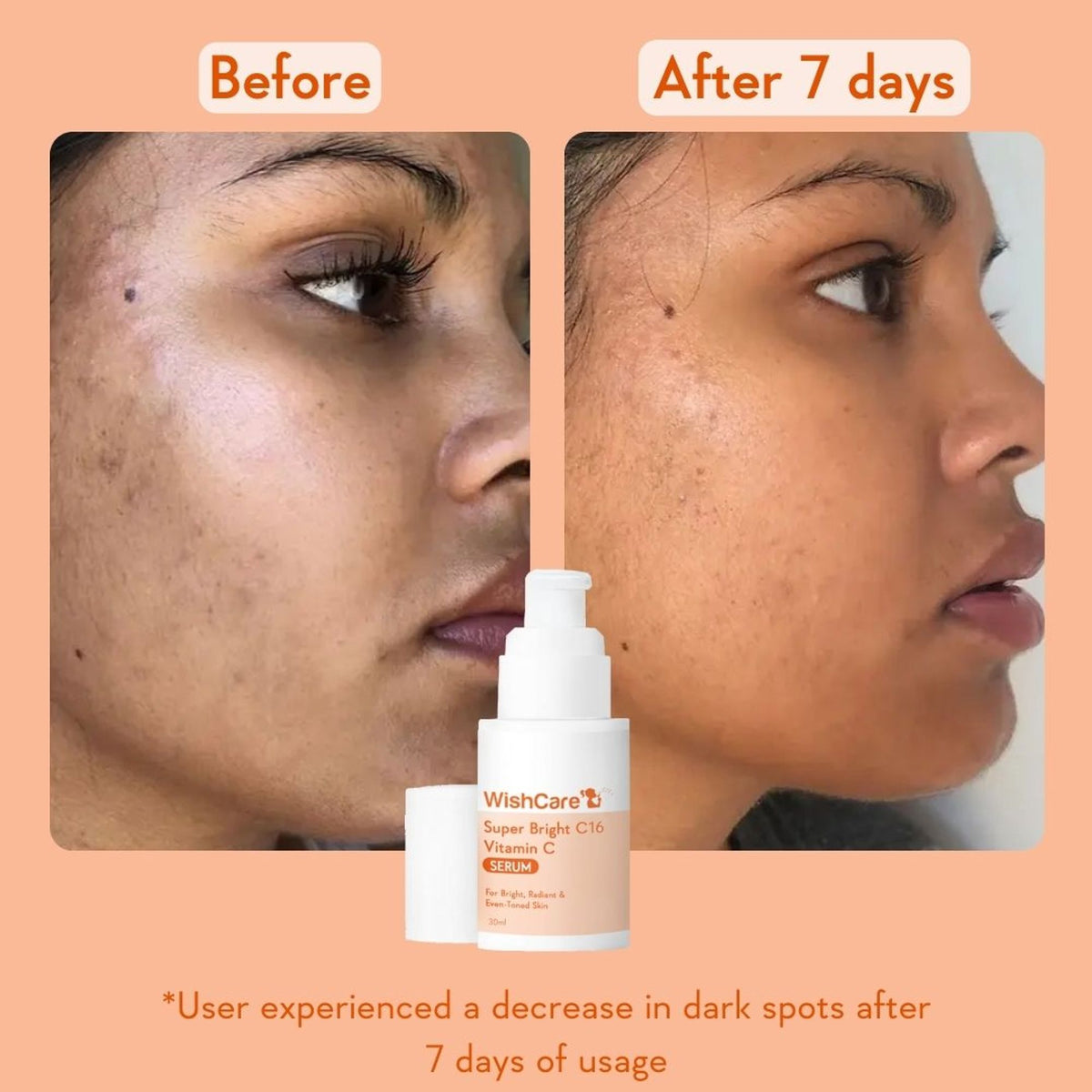 WishCare Super Bright C16 Vitamin C Face Serum for Glowing Skin- Reduces Pigmentation & Dark Spots